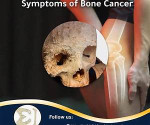 Bone Cancer (Cancer cures in detail Book 5)